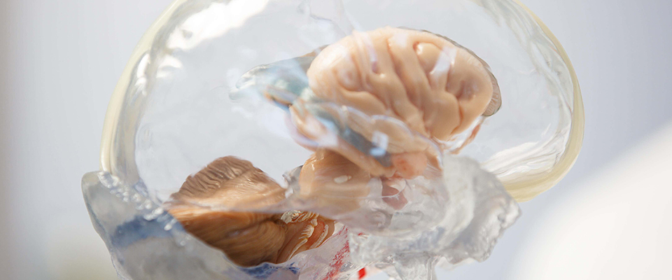 An anatomical model of the brain is on display against a blurred background